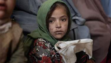 3 کودک از هر 10 کودک در افغانستان با گرسنگی مواجه‌اند