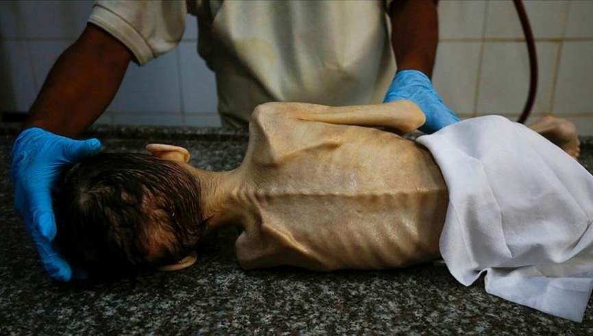 فاجعه قحطی در غزه: بیش از 80 کودک بر اثر گرسنگی جان دادند